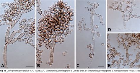 Figure 1 From Biodiversity In The Cladosporium Herbarum Complex