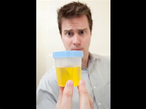 this man has been drinking his own urine for the last 6 years