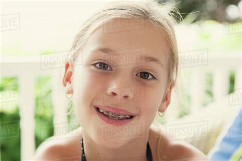 Caucasian Girl Smiling With Braces Stock Photo Dissolve