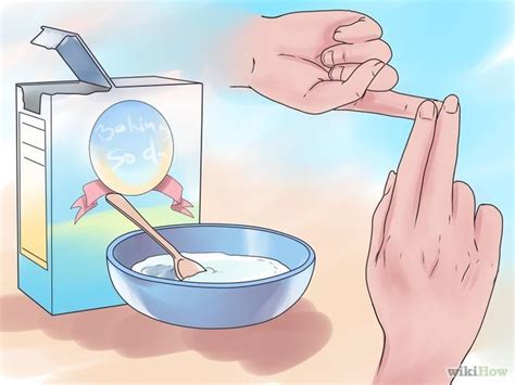 How to Remove a Splinter | Splinter removal, How to remove ...