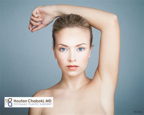 Botox For Excess Underarm Sweating