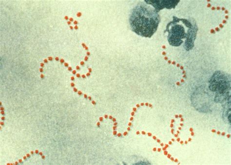 Streptococcus Pyogenes Scheda Batteriologica Ed Approfondimenti
