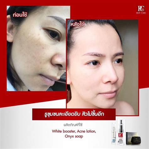 White Booster Mask By Pcare Skin Care Thailand Best Selling Products