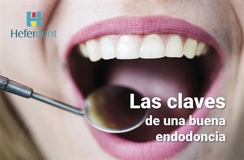 Las claves de una buena endodoncia | Clínica dental en Sevilla