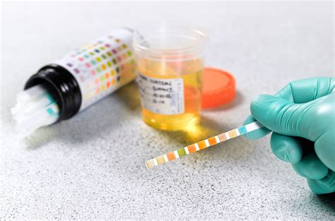 Drug Testing – Security