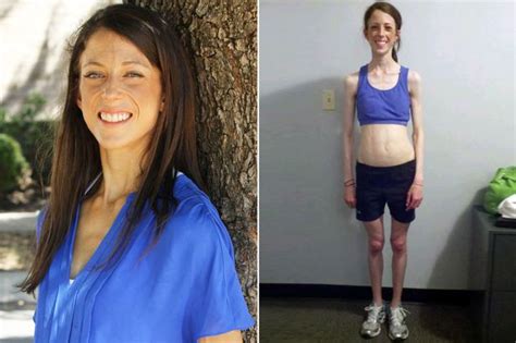 anorexic woman at risk of dying after dropping to 5st looks incredible after weightlifting aids
