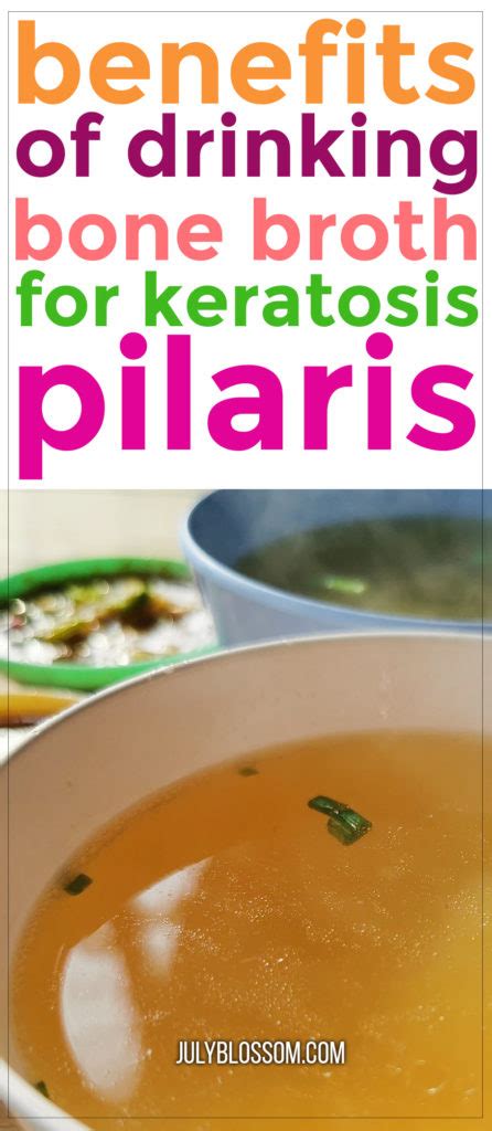 Why You Should Drink Bone Broth For Keratosis Pilaris July Blossom