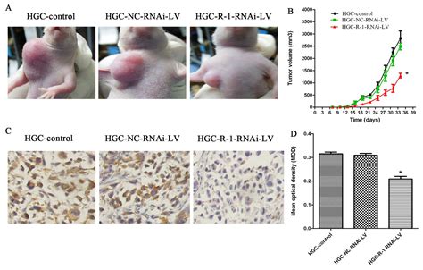 Xenograft Tumor Models Reflected Gastric Cancer Growth In Nude Mice And