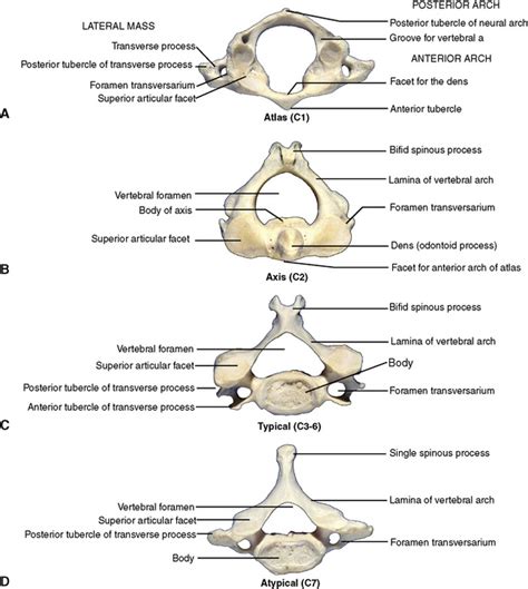 Typical Cervical Vertebrae Superior View Rwanda 24