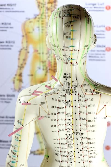 Acupuncture Calandra Center For Health And Wellness