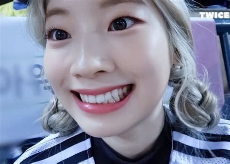Pin By Aryanii Seokjin On Dahyun Sensitive Teeth Kpop Girls Korean