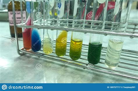 Mix Biochemical Test In Microbiology Laboratory Stock Image Image Of