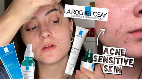 Testing La Roche Posay Effeclar Skincare Routine On Acne Sensitive