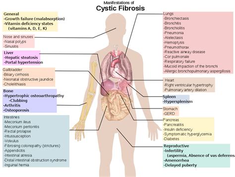 Cystic Fibrosis Physician Cancer Therapy Advisor