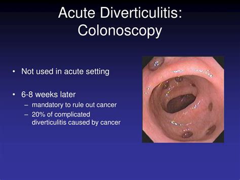 Ppt Diverticular Disease Powerpoint Presentation Free Download Id