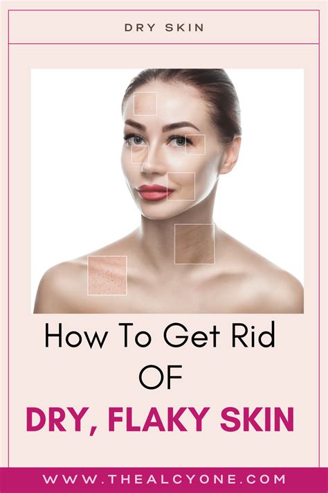 How To Get Rid Of Dry Flaky Skin Artofit