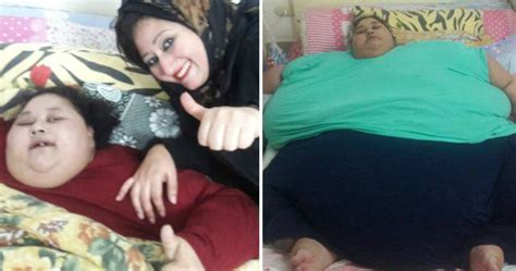 world s fattest woman lost 5st in a week before lifesaving operation metro news