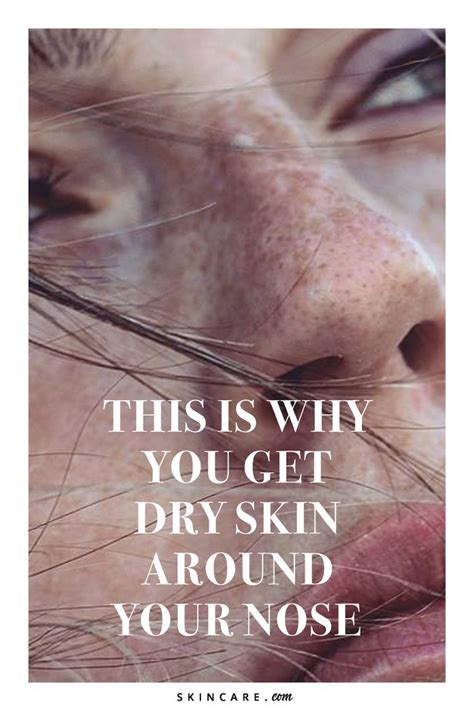 This Is Why You Get Dry Skin Around Your Nose By Loréal