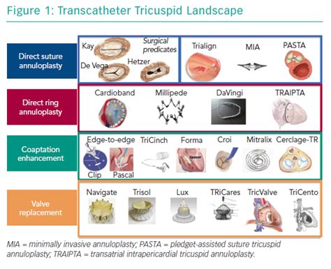 Transcatheter Tricuspid Landscape Radcliffe Cardiology