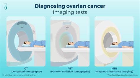Slide Show Diagnosing Ovarian Cancer
