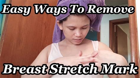 Easy Ways To Removed Breast Stretch Marks Filipina Sa Amerika Youtube