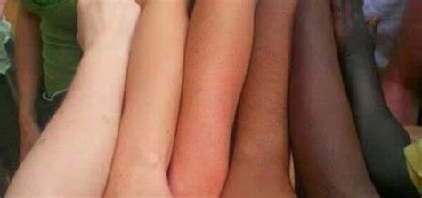 What Is The Colour Of Human Skin Why It Is Not Available