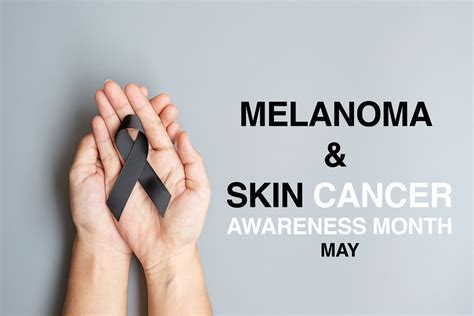 Melanoma Awareness Month Why Should You Schedule A Yearly Skin Exam