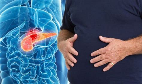 Pancreatic Cancer Symptoms Signs Include Pain In Stomach Area Uk