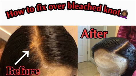How To Fix Over Bleaching Knotftdreamz Wig Youtube