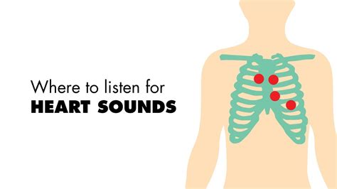 Where To Listen For Heart Sounds Auscultory Areas Medzcool Youtube