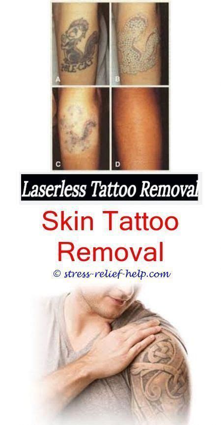 The laser hair removal treatment may cause pain, redness, or irritation, leading to further skin problems. How much does tattoo removal cost in india.What tattoo is ...