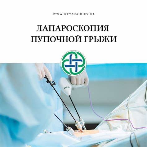 Кто похудел после лапароскопии