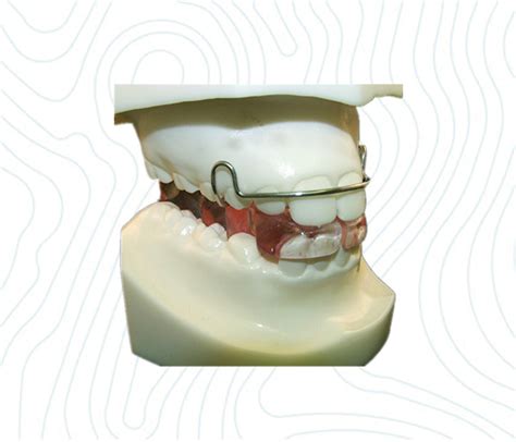 Bionator China Orthodontic