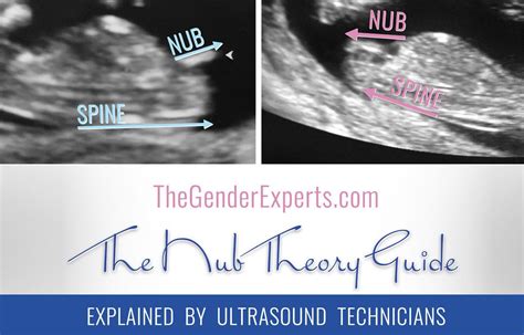 Nub Theory Highly Reliable Early Gender Prediction Nub Theory