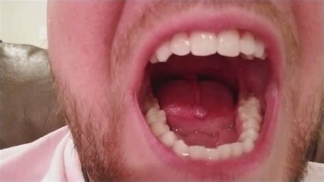 Longest Uvula Out There Youtube