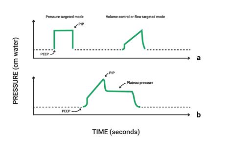 Ventilator Waveforms And Graphics Made Easy Overview