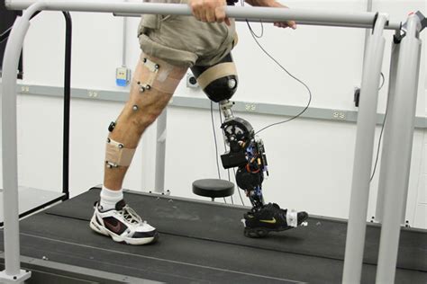 alumnus design of powered prosthetic leg aims to give amputees more control news center the