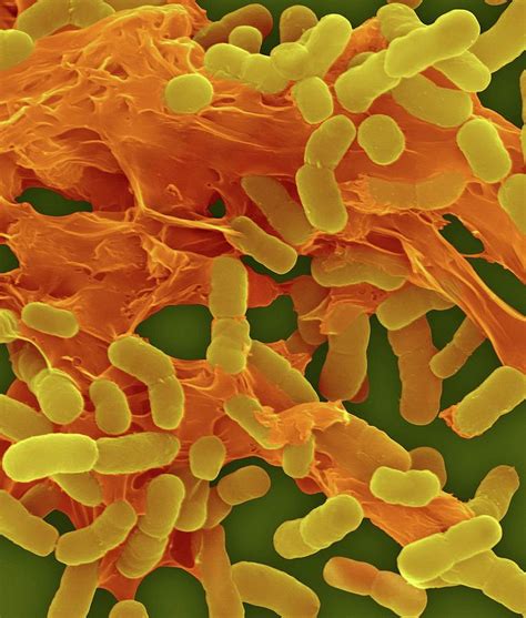 Acinetobacter Baumannii Photograph By Dennis Kunkel Microscopy Science My Xxx Hot Girl