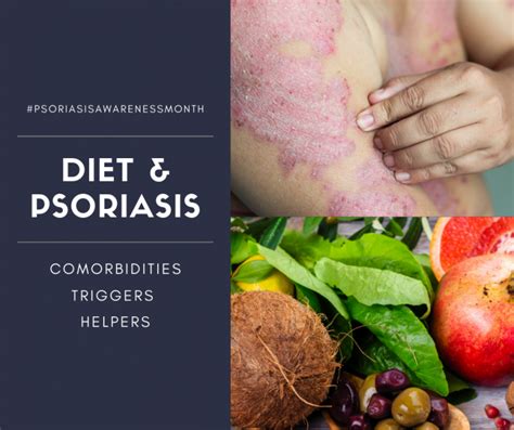 Diet And Psoriasis Providing Evidence Based Advice To Our Patients