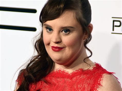 9 People With Down Syndrome Who Are Changing The World Down Syndrome