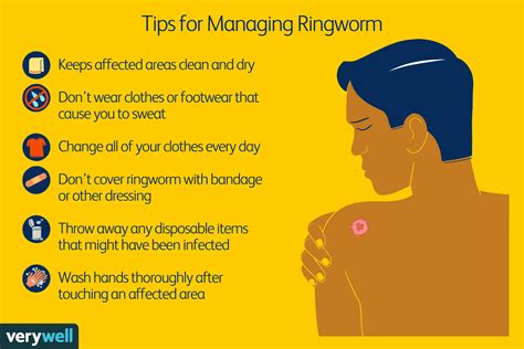 Ringworm Treatment Otc Prescription And Natural Options