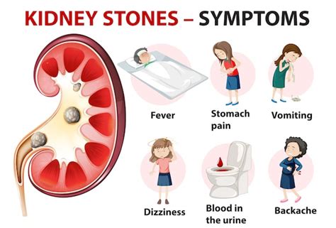 Free Vector Kidney Stones Symptoms Cartoon Style Infographic