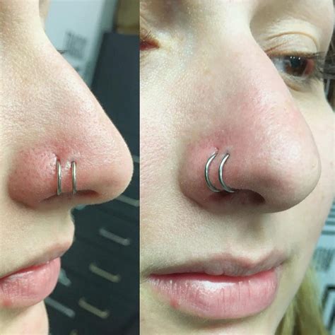 Normal Healing Process Of Nose Piercing