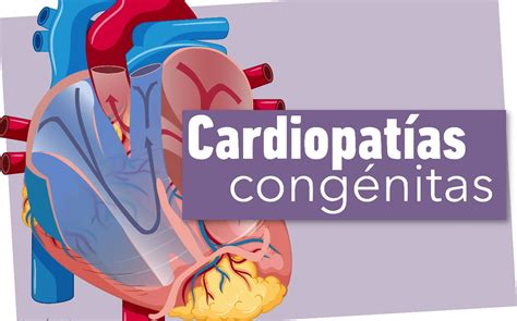 Cardiopatías Congénitas Salud Facmed