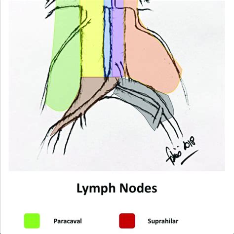 Retroperitoneal Lymph Nodes Anatomy Anatomy Drawing Diagram Images