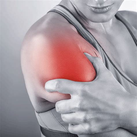 Shoulder Impingement Syndrome And Tears Of The Rotator Cuff Neill