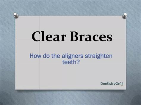 Ppt Clear Braces In Markham Powerpoint Presentation Free Download
