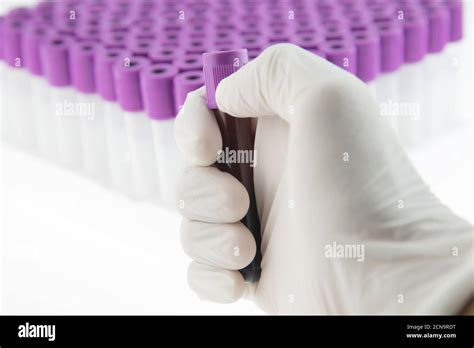 Edta Hi Res Stock Photography And Images Alamy