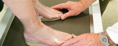 custom foot orthotics edmonton ab proactive physiotherapy