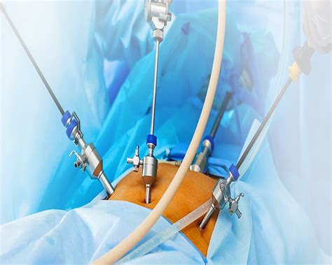 General And Laparoscopic Surgery An Excellent In Healthcare Solutions